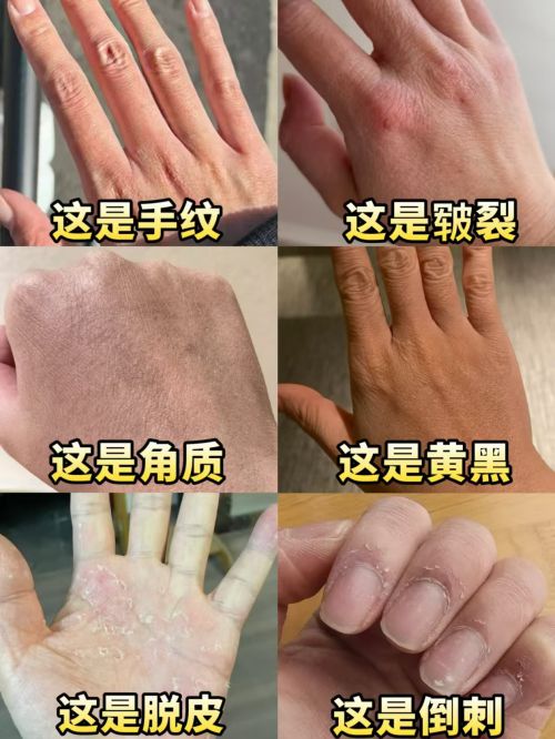 行榜推荐排行榜十款公认好用的护手霜九游会j9登录2025年）护手霜排(图2)